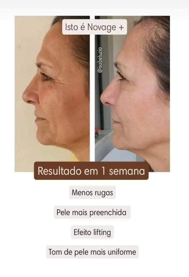 Novodge+ Results in 1 Semana | Health | Ana Lúcia | YESODI