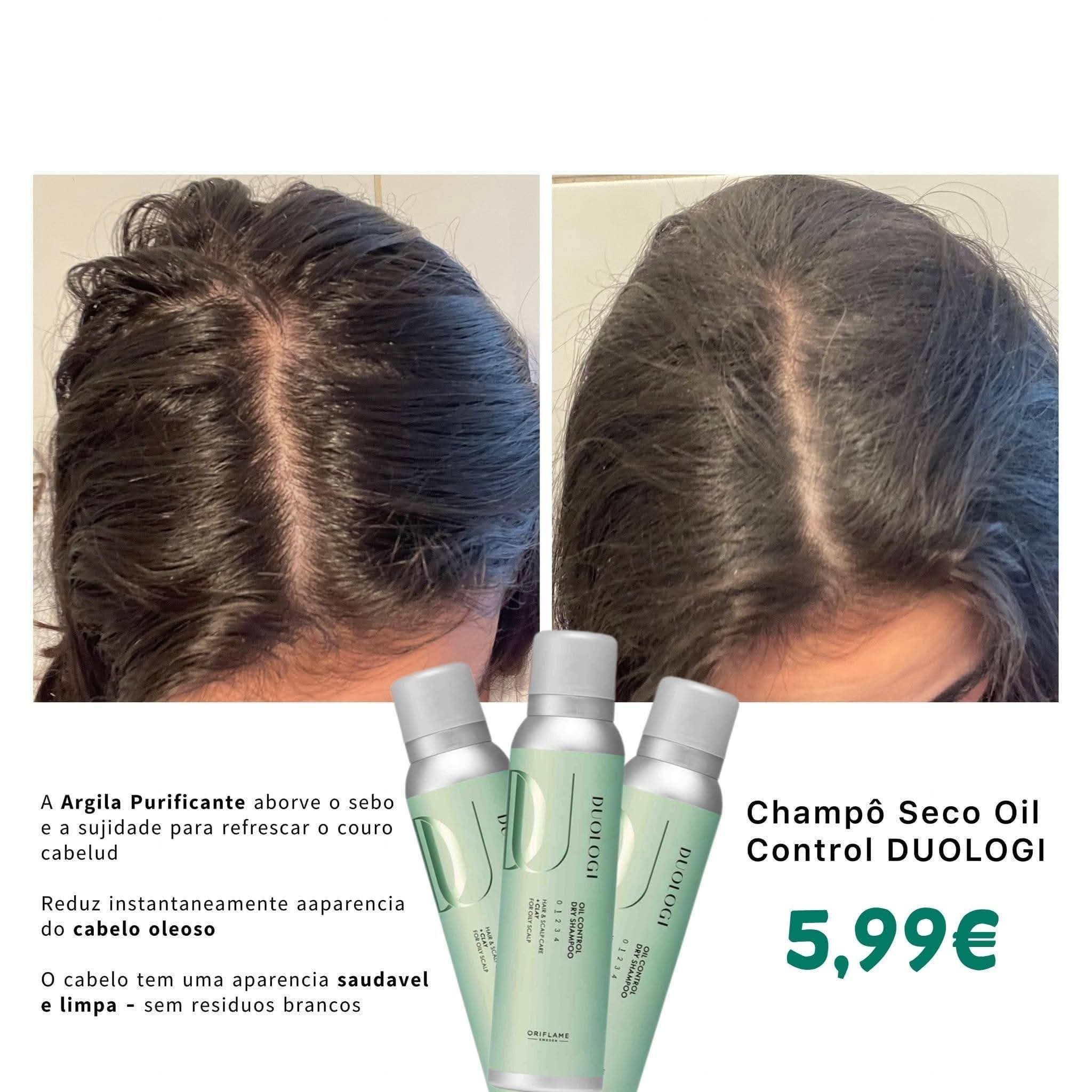 Before and after comparison showing hair appearance with dry shampoo product application for oil control.